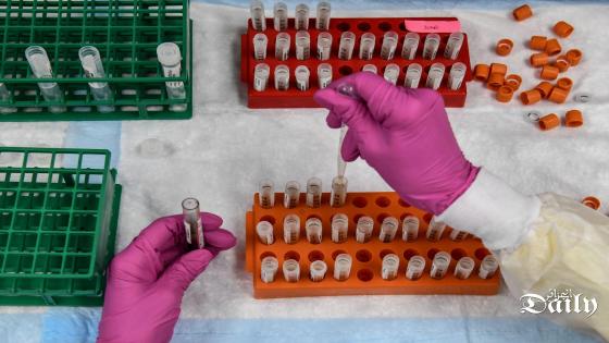 موعد انتهاء تجارب المرحلة الثالثة للقاح الروسي ضد كوفيد19.
