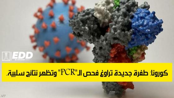 كورونا: طفرة جديدة تراوغ فحص الـ”PCR” وتظهر نتائج سلبية.