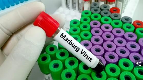 منظمة الصحة العالمية تعلن تفشي فيروس ماربورغ في غانا
