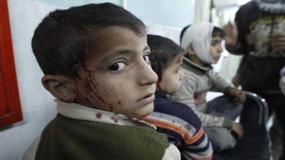 الجزائر ستستقبل 400 طفل فلسطيني مصاب لتقلي العلاج
