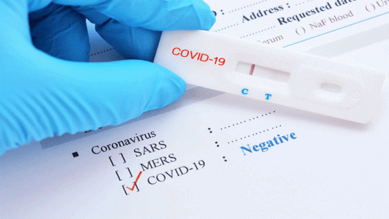 تسجيل 5 إصابات جديدة بفيروس كورونا